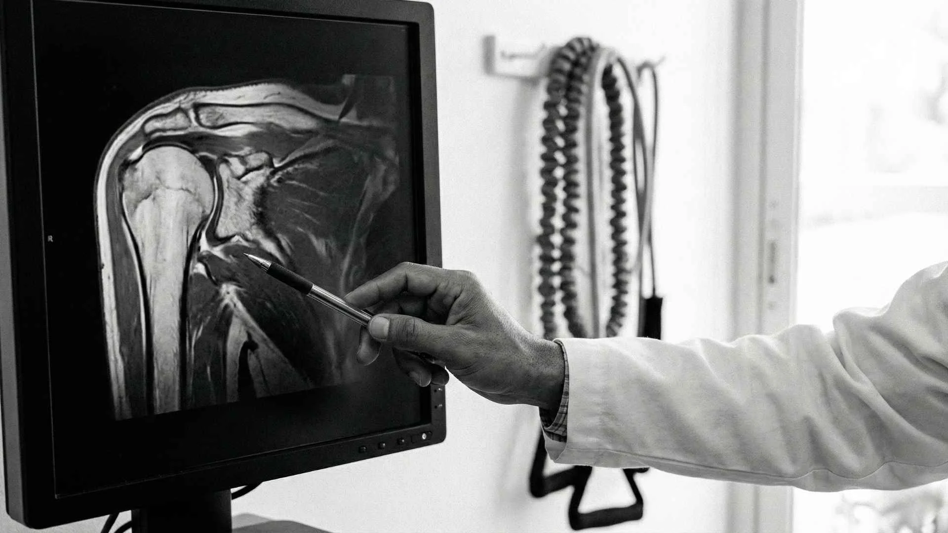 Shoulder Arthroscopy in Puerto Vallarta | Dr. Francisco Hernandez